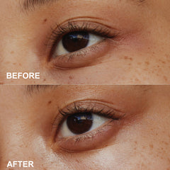 Hyaluronic Acid Eye Cream – Brightening Peptides Depuffing Gel
