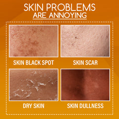 OUHOE Orange Peel Body Lotion – Brightening & Moisturizing Treatment with Natural Citrus Extracts