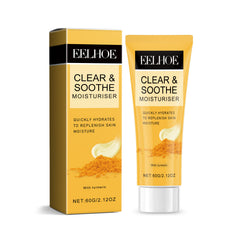 Oil-Free Moisturizer – Lightweight Hydration for Acne-Prone Skin