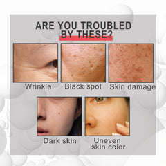 EELHOE Collagen Cream – Deep Hydration Moisturizer for Face