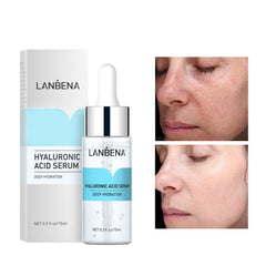 Hyaluronic Acid + Vitamin C Serum – 10% HA 15% L-Ascorbic 15ml